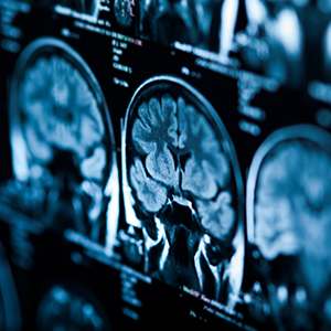 brain scan image