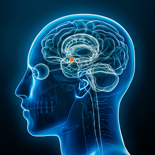 xray image illustration of a brain